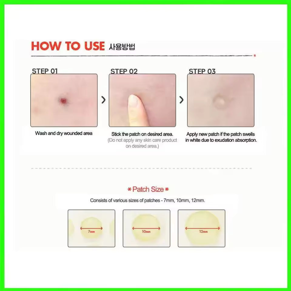 Acne Pimple Spot Patch Stickers – Scar and Blemish Care