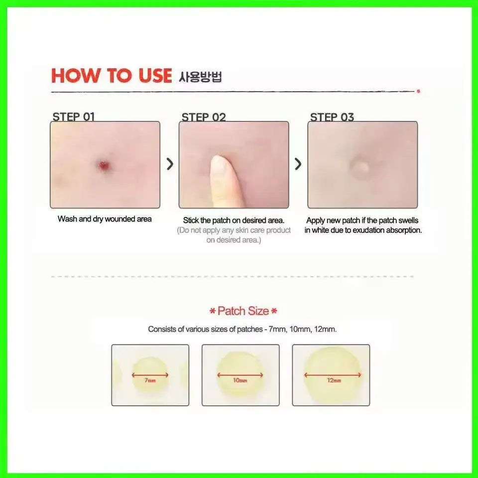 Acne Pimple Spot Patch Stickers – Scar and Blemish Care My Store