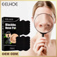 Blackhead Removal Nose Strips
