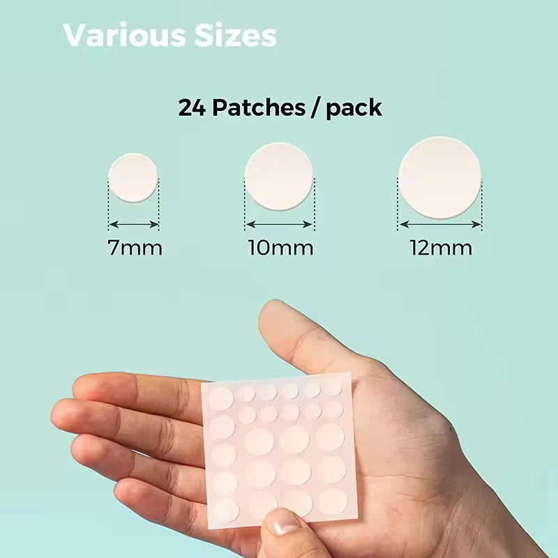 Acne Pimple Spot Patch Stickers – Scar and Blemish Care
