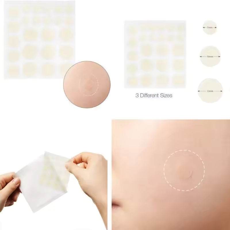 Acne Pimple Spot Patch Stickers – Scar and Blemish Care