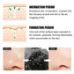 Blackhead Removal Nose Strips