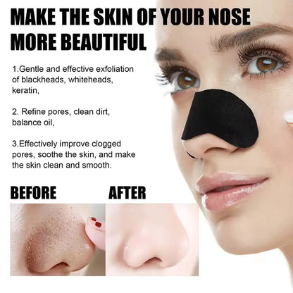 Black Head Removal Nose Strips My Store